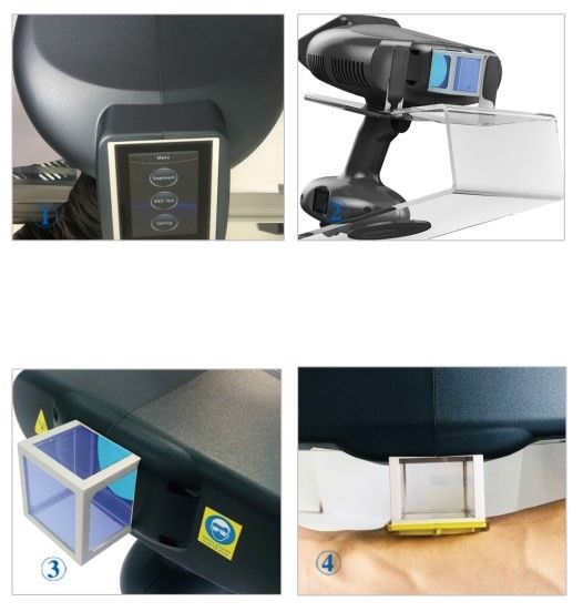 Home Use Vitiligo Excimer Laser Therapy White Spot 308nm